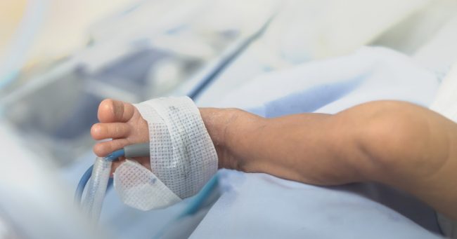 biliary atresia surgery