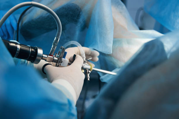 laparoscopic-robotic-pyeloplasty-surgery-in-mumbai